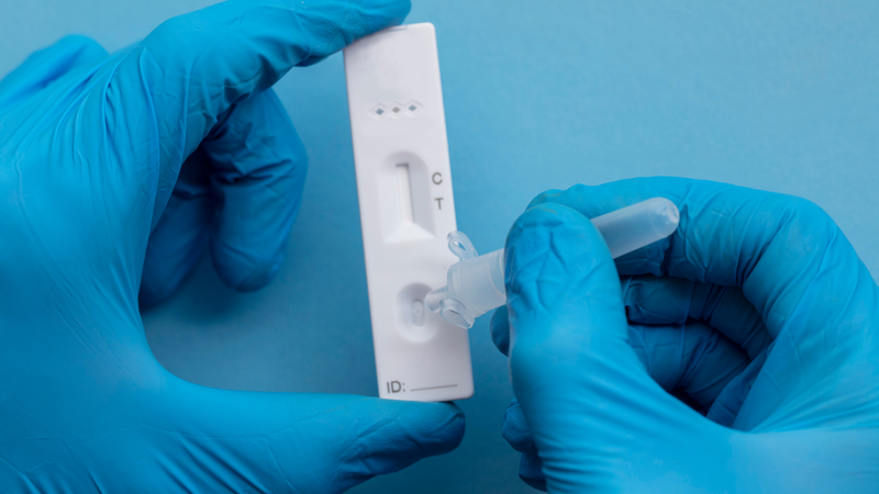 Test nhanh cúm giúp phân biệt cúm A và cúm B chỉ trong 15 - 30 phút