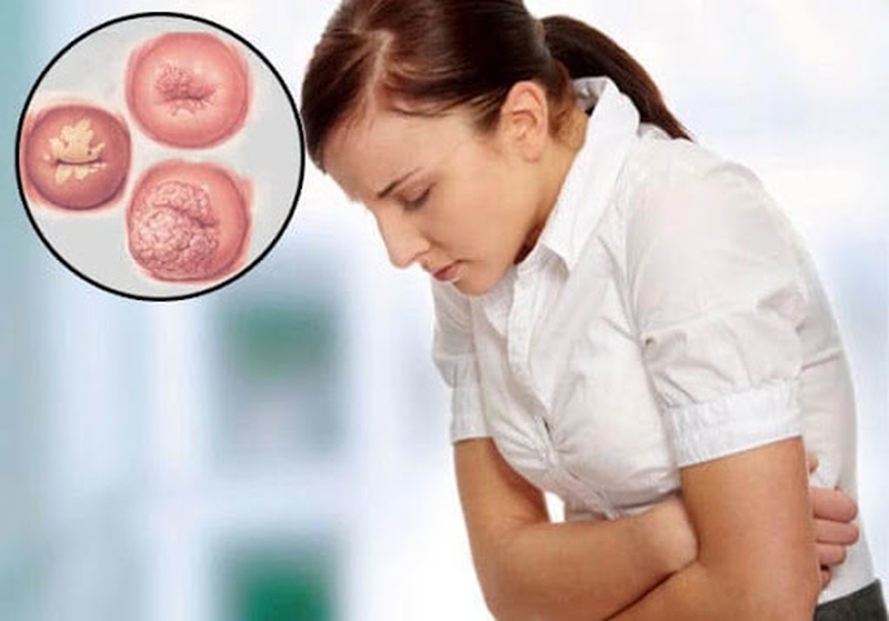 dau-hieu-mac-benh-viem-co-tu-cung-nguyen-nhan-va-dieu-tri-viem-co-tu-cung-la-gi-1