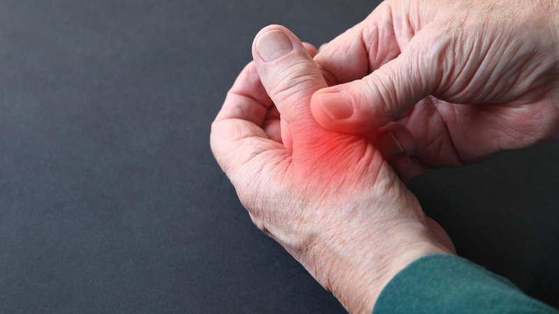 Tình trạng cứng khớp ở ngón tay cái gây sưng, đỏ tại khớp kèm cảm giác đau âm ỉ