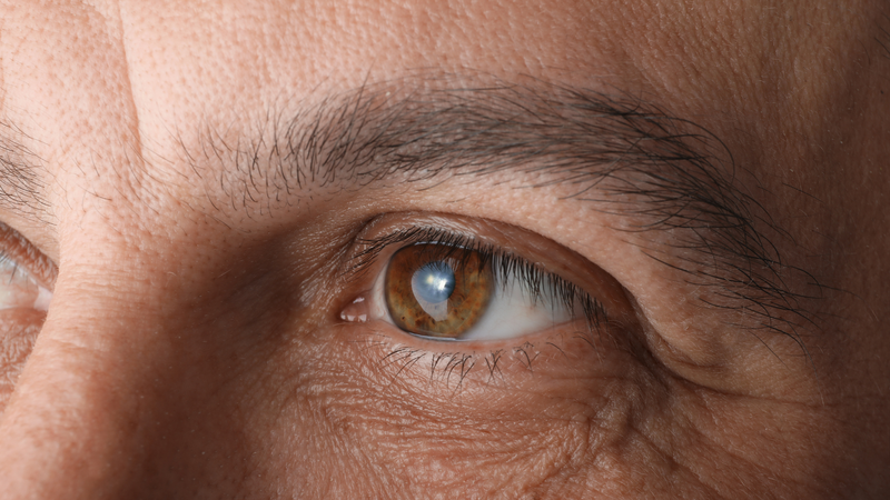 Cườm mắt là gì? Nguyên nhân, triệu chứng và cách điều trị hiệu quả 2