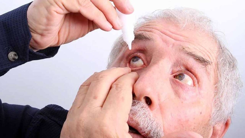 Cườm nước căn bệnh nguy hiểm và cách điều trị 3