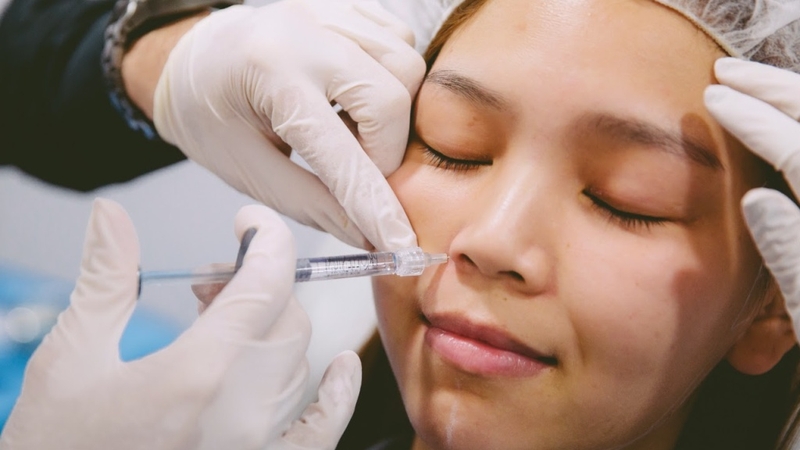 Cuộn cánh mũi: Phương pháp thẩm mỹ an toàn cho dáng mũi đẹp tự nhiên 4