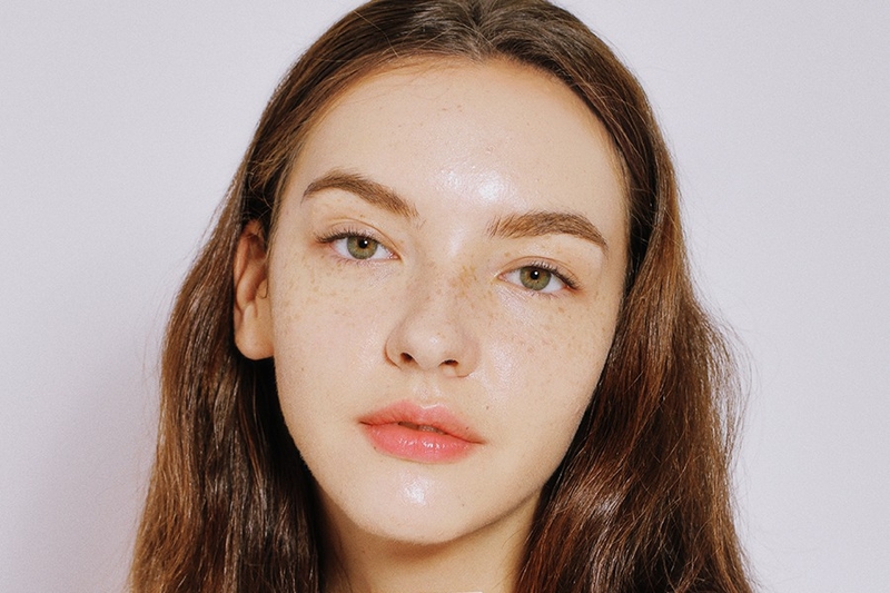 Da bị nám nhẹ do đâu? Cách điều trị hiệu quả cho làn da mới bị nám 1