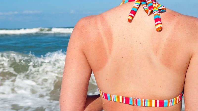 Da body không đều màu: Nguyên nhân và cách khắc phục hiệu quả 1