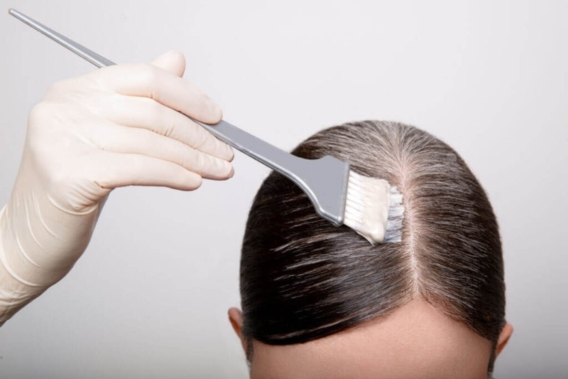 Da đầu bị ngứa và nổi mụn là do bệnh gì? 2