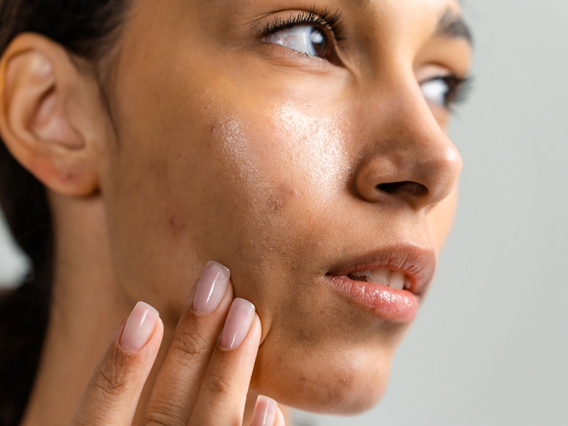 Da dầu nên phun hay điêu khắc? Ưu nhược điểm của 2 phương pháp 4