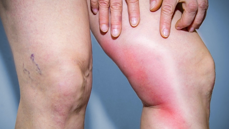 Da đau rát như bị bỏng là hiện tượng gì? Có nguy hiểm không? 1