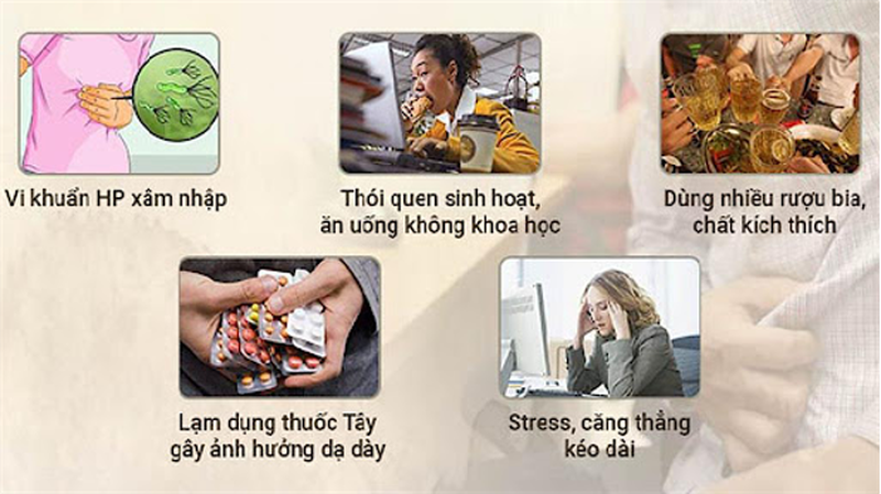 Những lưu ý khi bị dị ứng thuốc dạ dày 1