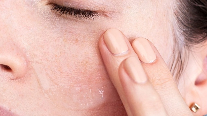 Da mặt bị cháy nắng đỏ rát phải làm sao để hồi phục 3