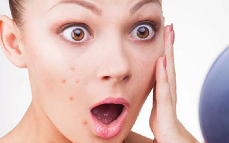 Da mặt bị dị ứng và cách điều trị 2