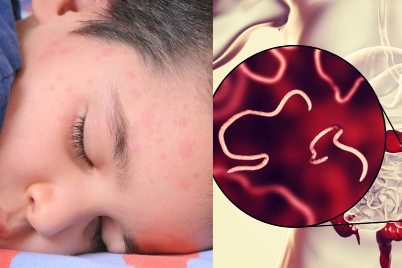 Da mặt bị ngứa châm chích có nguy hiểm không? Cách xử lý thế nào 2