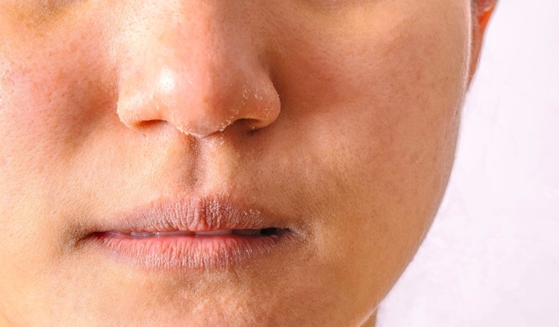 Da mặt khô nên dùng gì? Quy trình chăm sóc khoa học như thế nào? 1