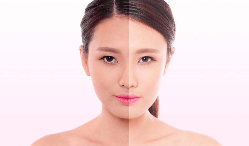 Da mặt sạm đen là bệnh gì? Cách khắc phục như thế nào hiệu quả? 1