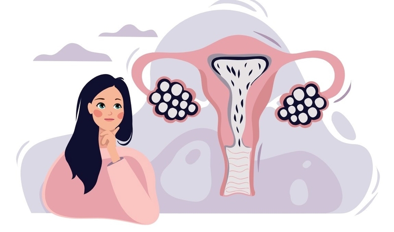 Đa nang buồng trứng có làm IVF được không? 1