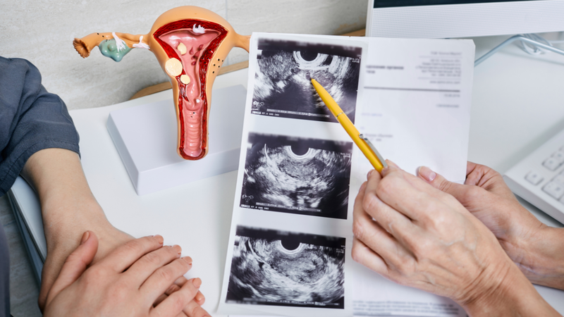 "Đa nhân xơ tử cung loại 4 có chữa được không?" là thắc mắc của nhiều người