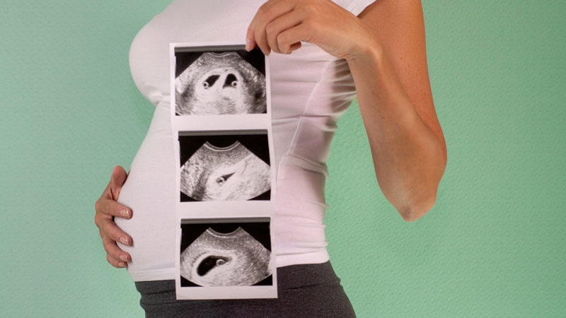 Thai phụ mang song thai hoặc đa thai có nguy cơ bị đa ối cao hơn so với thai đơn