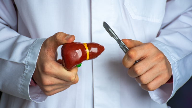 Tình trạng đa polyp túi mật phải xử trí như thế nào? 4