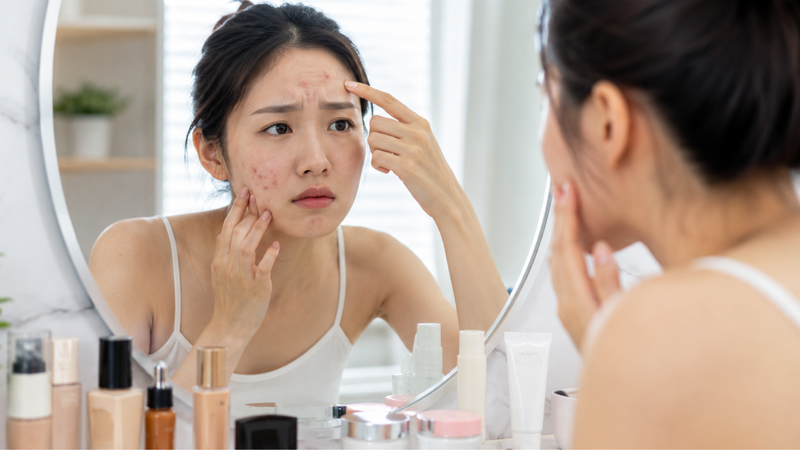 Mỹ phẩm không phù hợp có thể gây bít tắc lỗ chân lông và nổi mụn