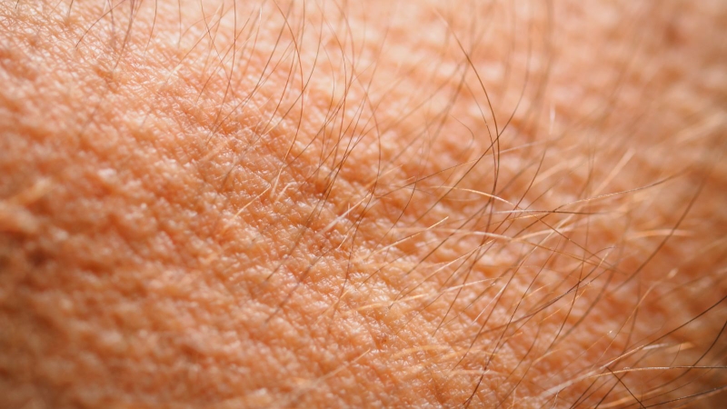 Da trẻ bị nổi sần như da gà: Nguyên nhân và phương pháp điều trị 1