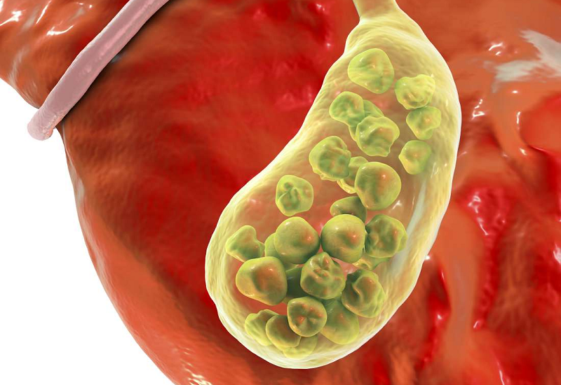 Da vàng là biểu hiện của bệnh gì - Bạn đã biết chưa? 3