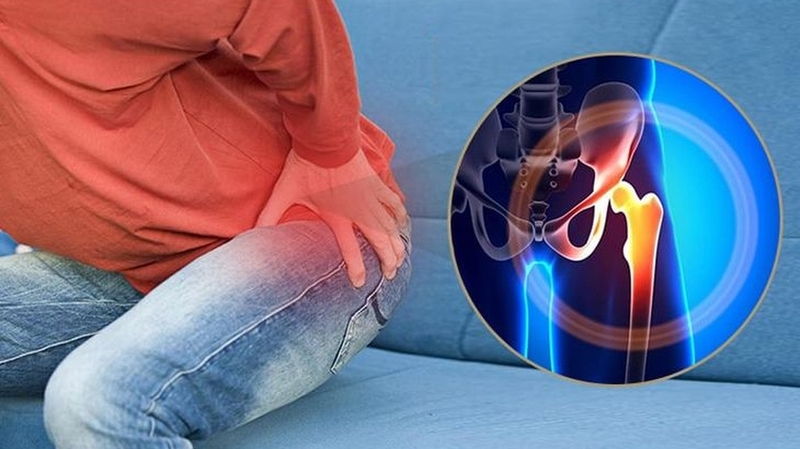 Đặc điểm các cơn đau khớp háng mà bạn nên biết 1