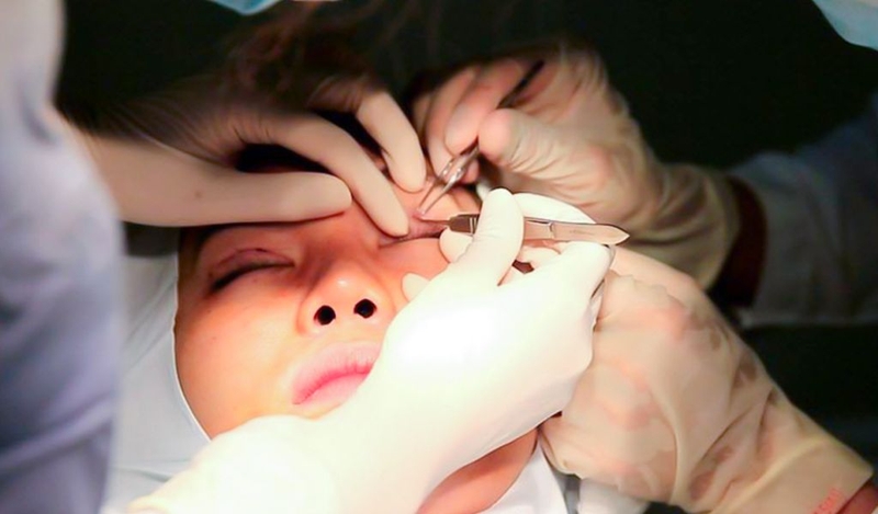 Đặc trưng của mắt 2 mí? Có cách tạo mắt 1 mí thành 2 mí rõ nét không? 3