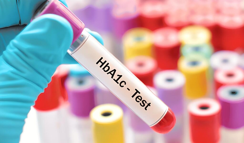 Đái tháo đường không phụ thuộc insulin: Những điều bạn cần biết 4