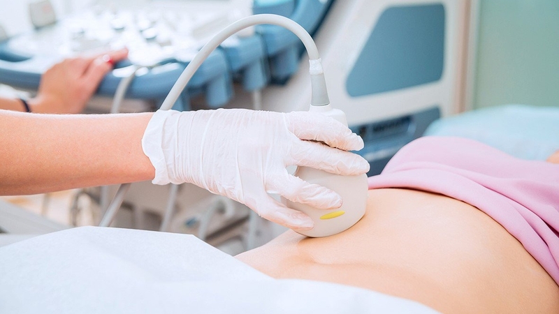 Đám quánh ruột thừa 02