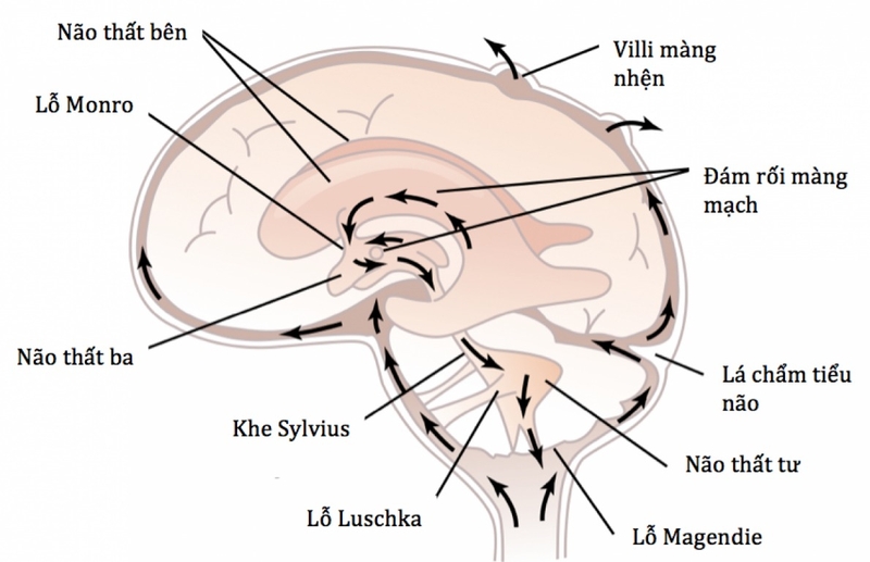 Dẫn lưu não thất được thực hiện khi nào? Quy trình phẫu thuật dẫn lưu não thất 1