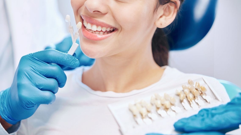 Tìm hiểu kỹ và chọn địa chỉ tin cậy khi dán Veneer