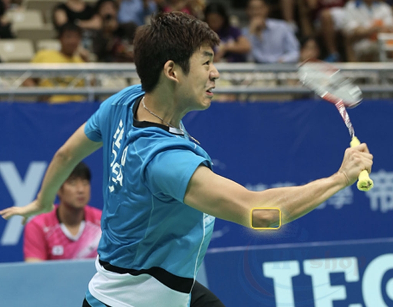 Đánh cầu lông bị đau khuỷu tay có nguy hiểm không? 1