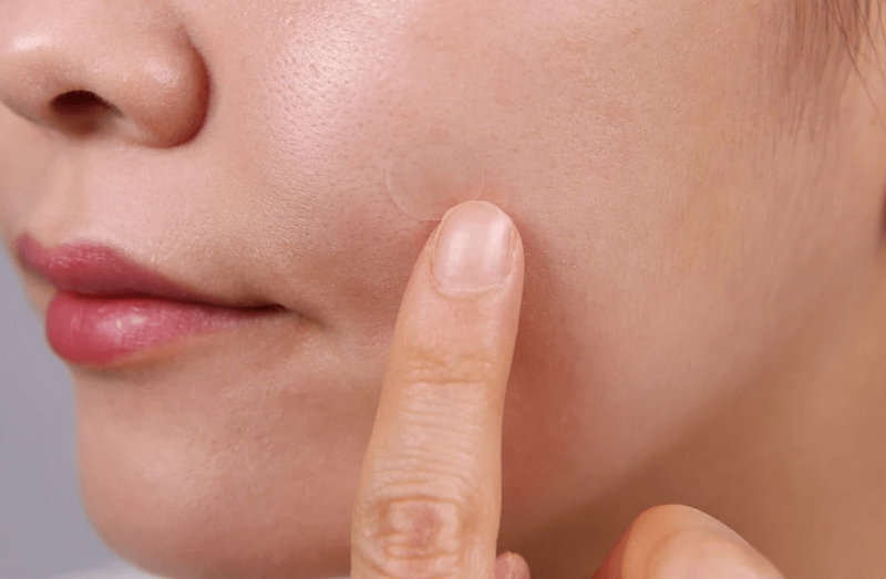 Đánh giá ưu nhược điểm của miếng dán mụn