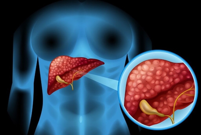 Danh sách các bệnh truyền nhiễm thuộc bệnh truyền nhiễm nhóm C 4