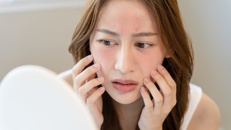 Đắp mặt nạ bị rát​ phải làm sao?2