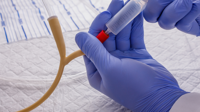 Đặt ống thông tiểu khi nào là vấn đề được nhiều người quan tâm