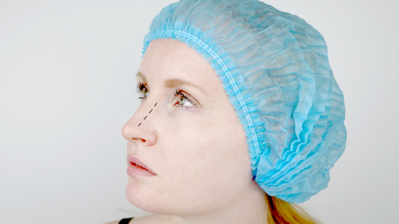 Đặt trung bì mỡ khi tháo sụn: Vì sao cần thực hiện và quy trình thế nào? 3