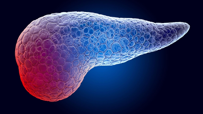 Đau bụng do viêm tụy cấp: Nguyên nhân, triệu chứng và cách điều trị 3