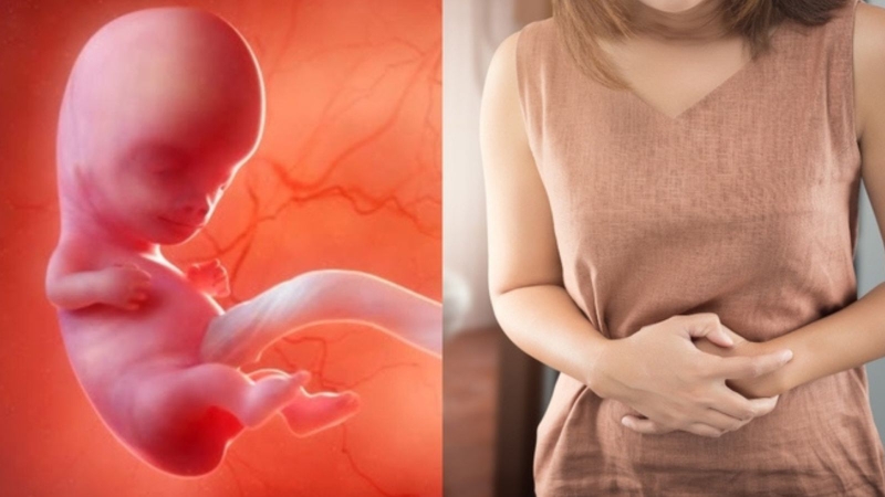 Đau bụng dưới sau khi sảy thai có nguy hiểm hay không? 1