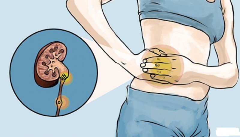 Đau bụng dưới và đau lưng có phải mang thai không? 4