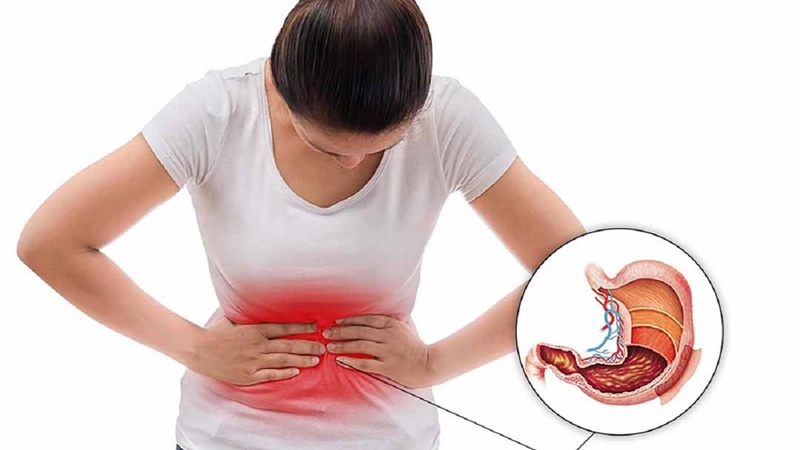 Đau bụng quặn từng cơn trên rốn do đâu? Hỗ trợ giảm đau hiệu quả 2