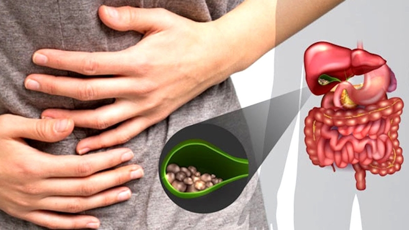 Đau bụng quặn từng cơn trên rốn do đâu? Hỗ trợ giảm đau hiệu quả 3