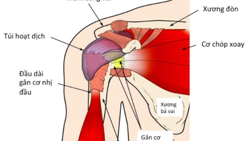 Đau chóp xoay khớp vai là gì?1