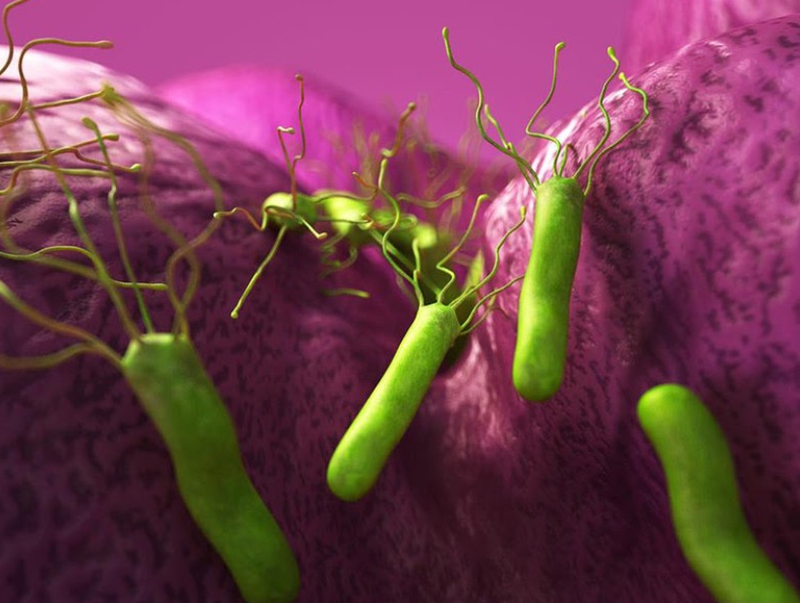 Nhiễm vi khuẩn Hp Vi khuẩn Hp xâm nhập vào dạ dày sẽ tác động đến lớp niêm mạc và phá hủy lượng chất nhầy tại đây. Từ đó tạo điều kiện để dịch vị dạ dày ăn mòn lớp niêm mạc dẫn đến tình trạng viêm nhiễm, hình thành ổ viêm kèm theo cảm giác đau buốt 2.