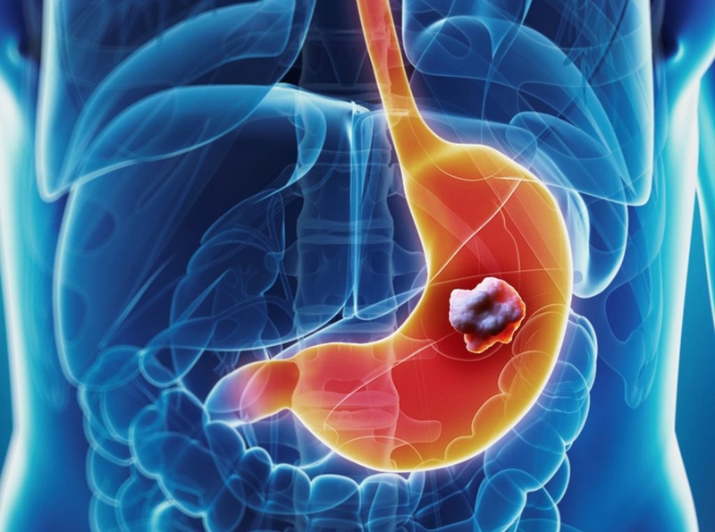 Khi bị đau dạ dày uống thuốc gì để cắt cơn đau hiệu quả 1