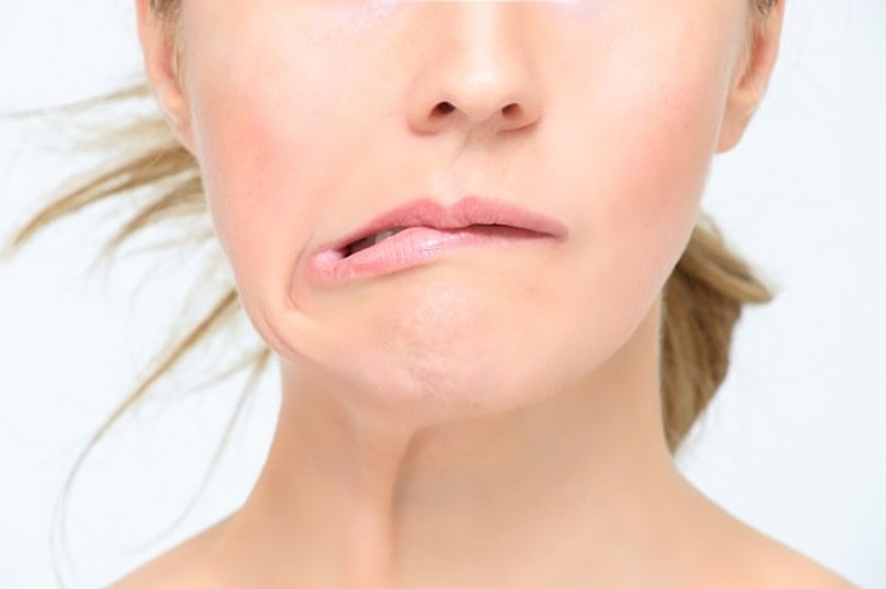 Cách phòng chống liệt dây thần kinh số 7 1