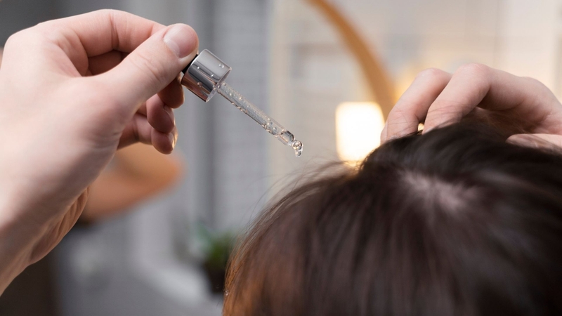 Có thể sử dụng các sản phẩm hỗ trợ chăm sóc tóc