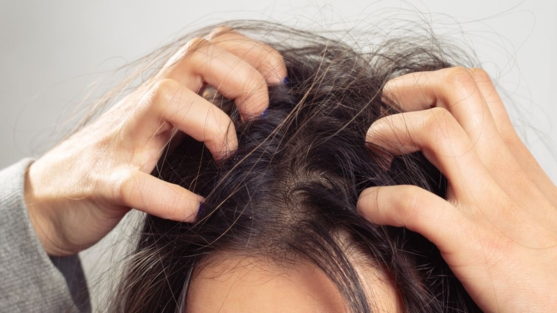 Nhiều người dùng dầu gội gừng cảm nhận được hiệu quả giảm gàu ngứa rõ rệt
