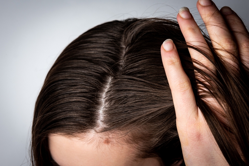 dầu gội nguyên xuân 1