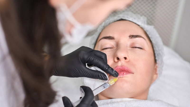 Áp xe sau tiêm filler là biến chứng nhiễm trùng nguy hiểm