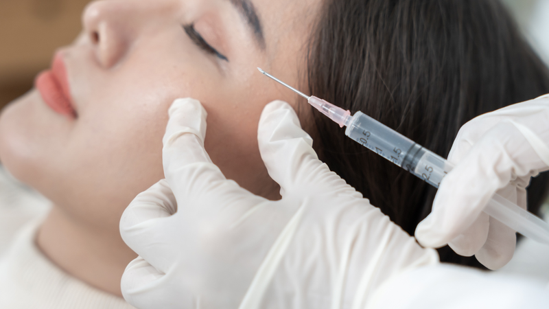 Áp xe sau tiêm filler có thể gây hoại tử mô hoặc để lại di chứng thẩm mỹ